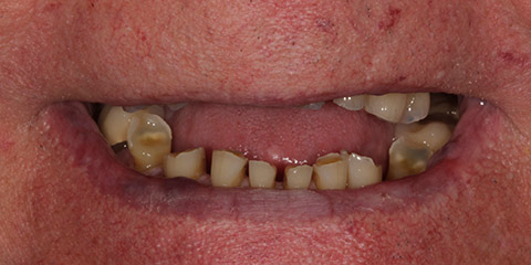 dennis-b-teeth-before